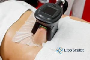 Does Fat Freezing At Home Work? 3 Fat freezing at home from Lipo Sculpt Leicester